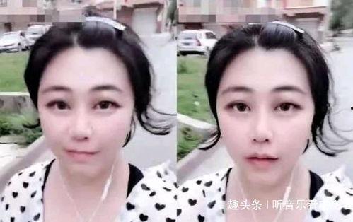 娱乐吃瓜酱鼻梁变高,揭秘明星整形新趋势 第3张 娱乐吃瓜酱鼻梁变高,揭秘明星整形新趋势 第3张
