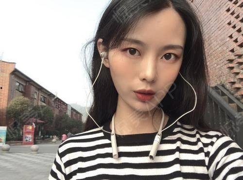 娱乐圈吃瓜水母头,揭秘“水母头”现象背后的秘密  第2张